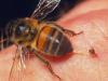 Người bình thường có thể chịu được bao nhiêu vòi ong cắn?